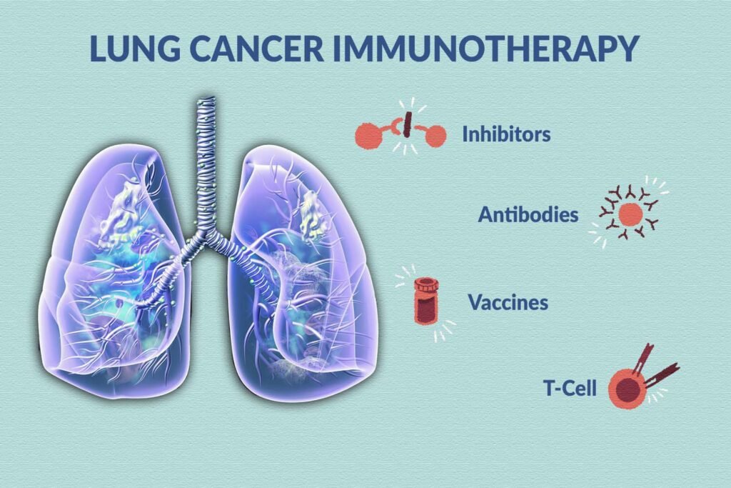 Lung Cancer Immunotherapy: No.1 Revolutionizing Treatment For A ...