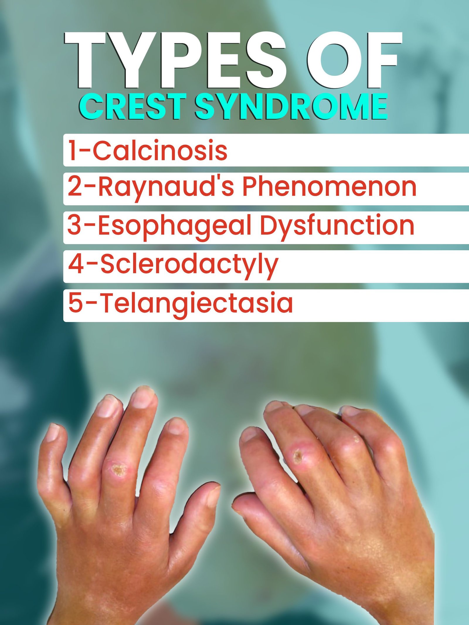 Types of crest syndrome