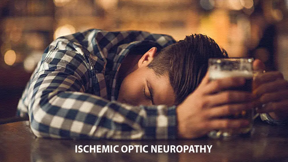 schemic Optic Neuropathy? A drunken man sleeping face down due to alcohol