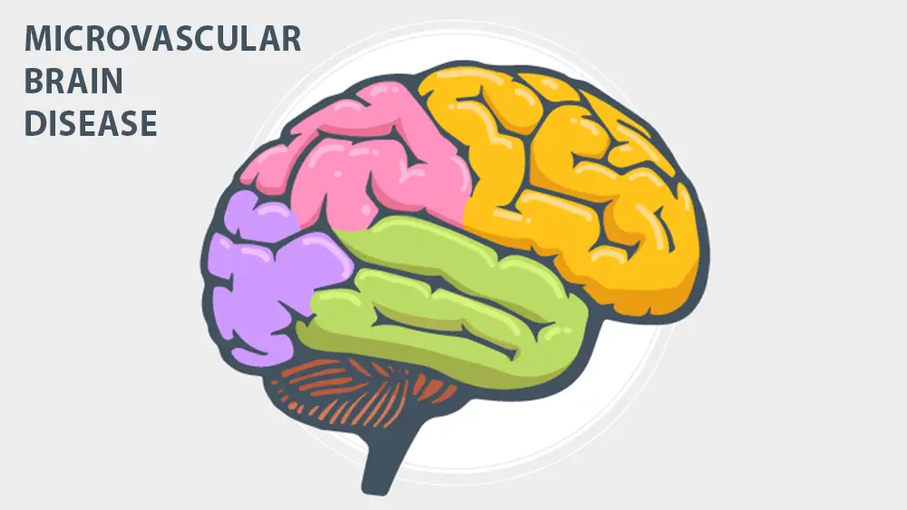 Microvascular Brain Disease