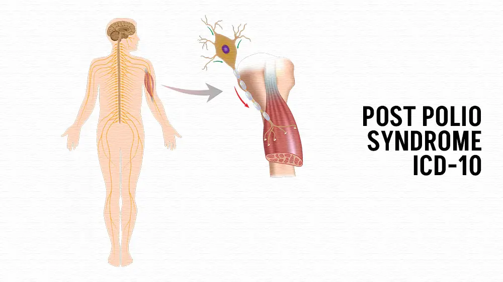 Post Polio Syndrome ICD-10