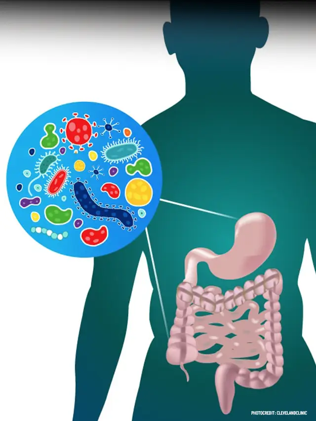 How to Improve gut Health Naturally