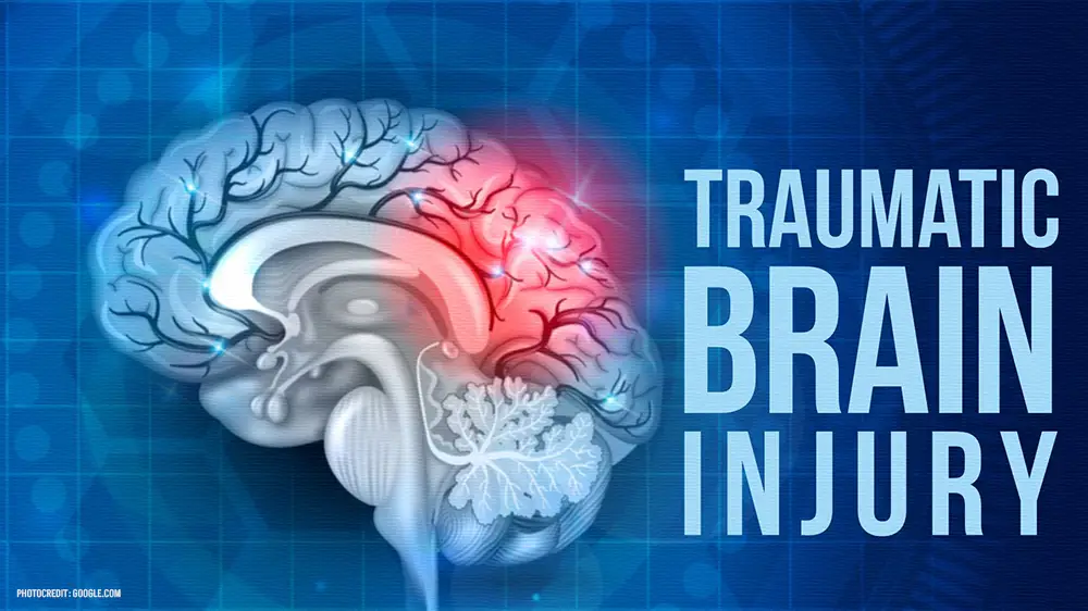 Traumatic Brain Injury TBI