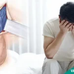 surgical varicocele treatment