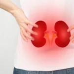 Acute Kidney Injury or AKI Chronic Kidney Disease