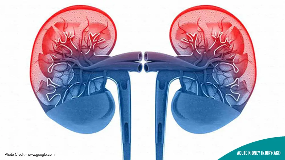 Acute Kidney Injury or AKI