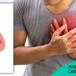 Hypertrophic Cardiomyopathy