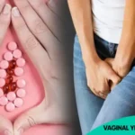 Vaginal Yeast Infections