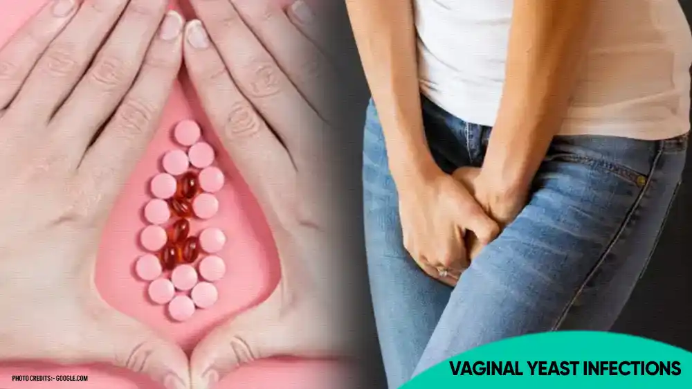 Vaginal Yeast Infections