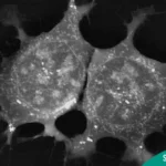 Stem Cell Therapy for Cancer