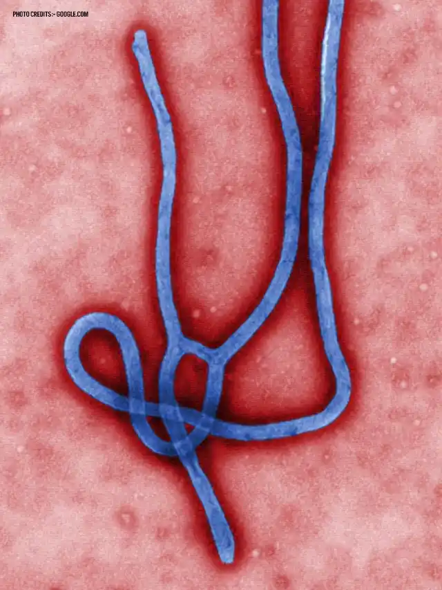 Ebola virus