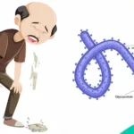 Ebola virus