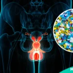 Microplastics