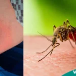 west nile virus