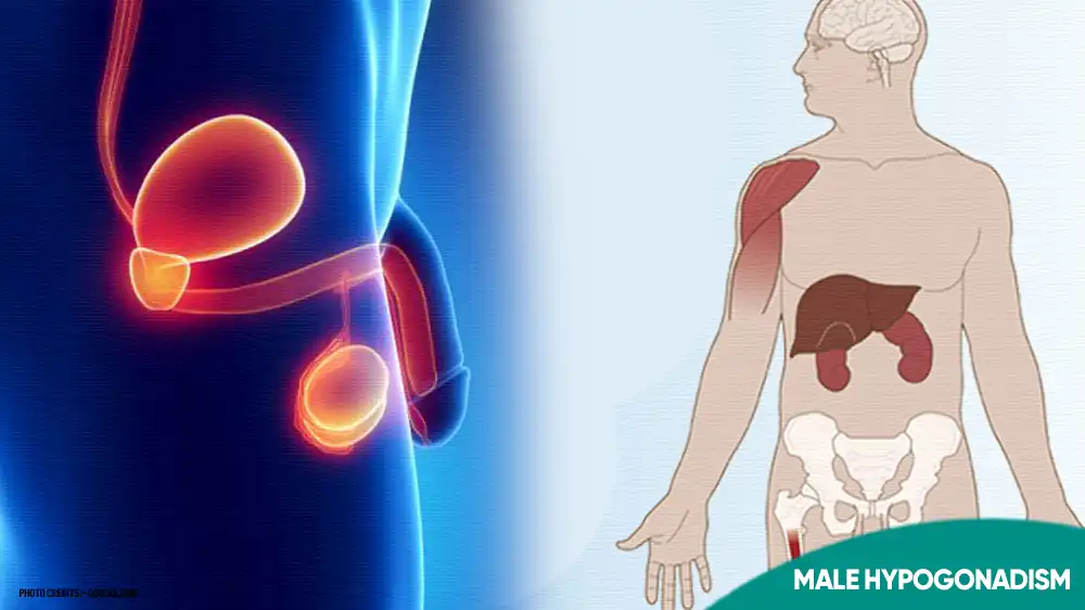 Male Hypogonadism