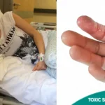 Toxic Shock Syndrome