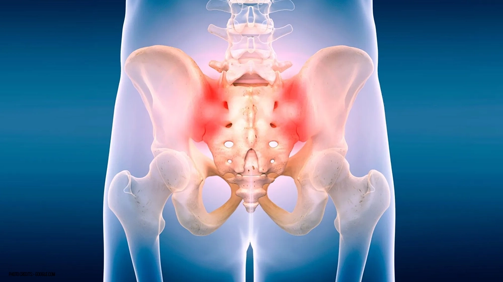 What Causes Sacroiliac Joint Pain