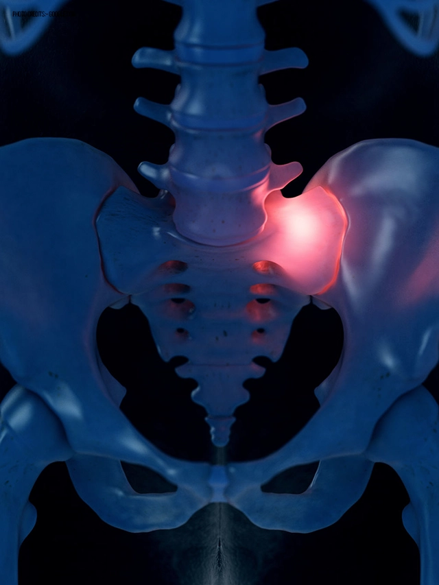 What Causes Sacroiliac Joint Pain