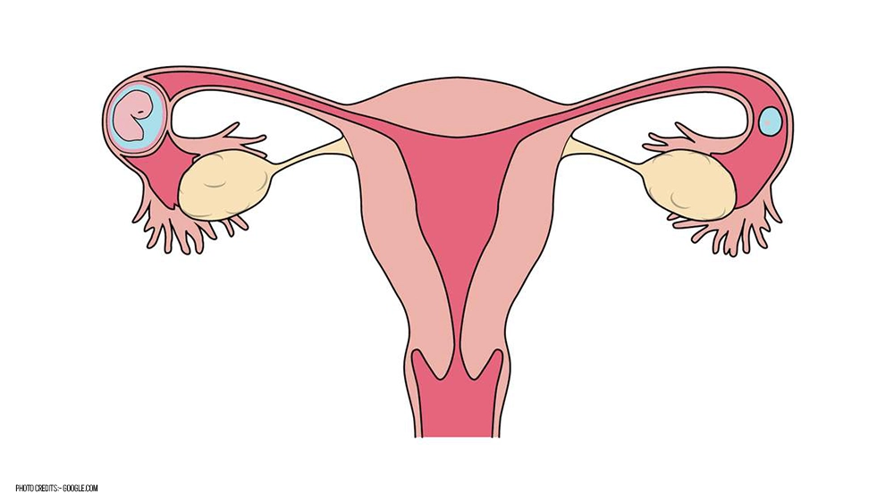 Signs of An Ectopic Pregnancy