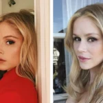 Erin Moriarty Before and After Cosmetic Surgery