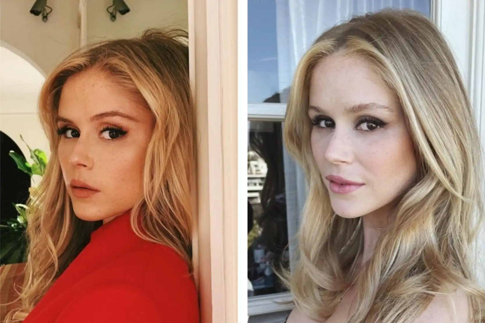 Erin Moriarty Before and After Cosmetic Surgery