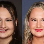 Gypsy Rose Blanchard nose job