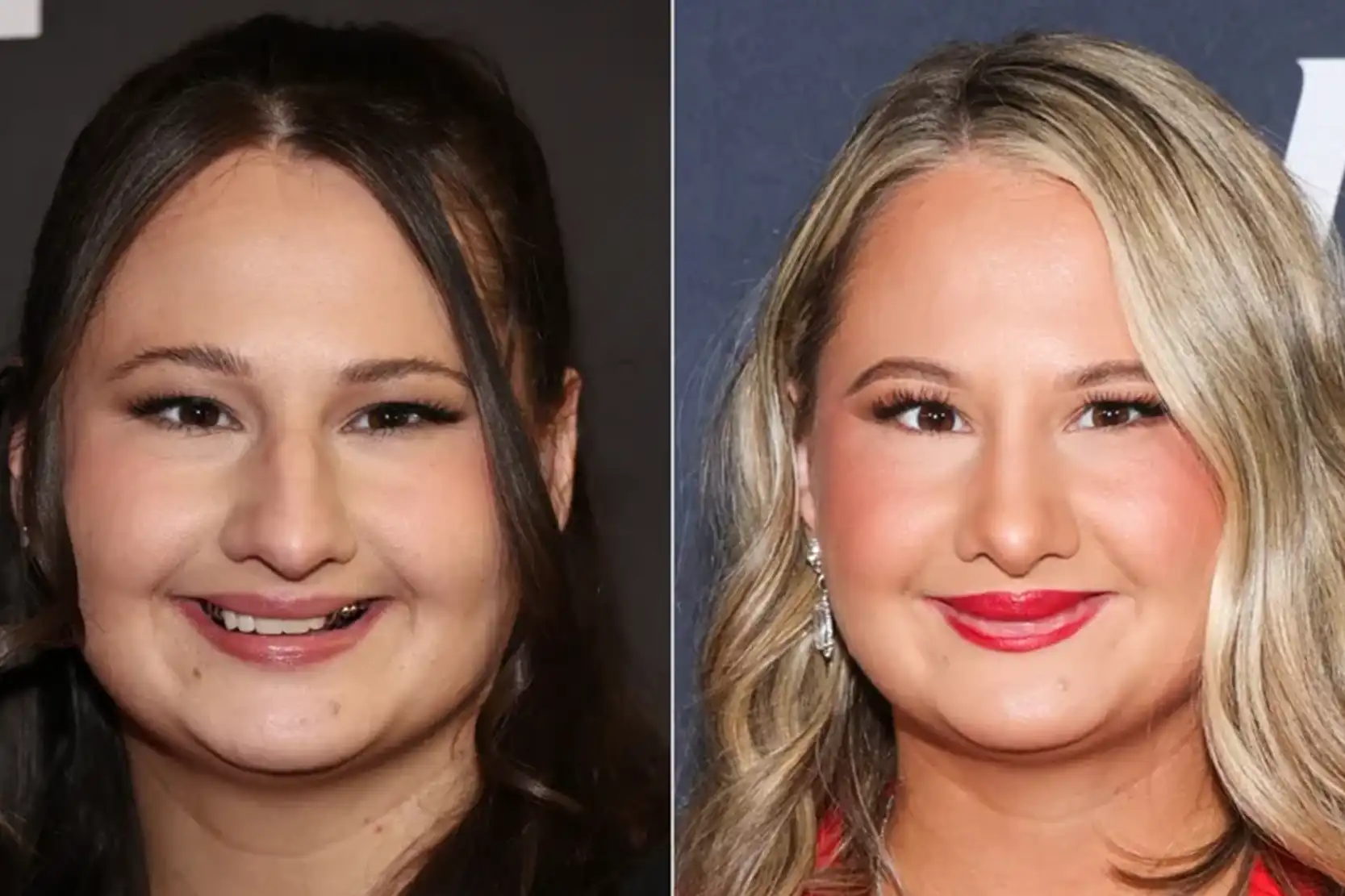 Gypsy Rose Blanchard nose job