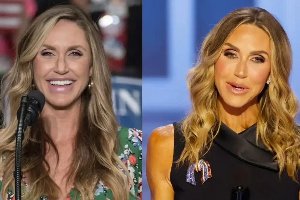 Lara Trump Before and After Cosmetic Surgery