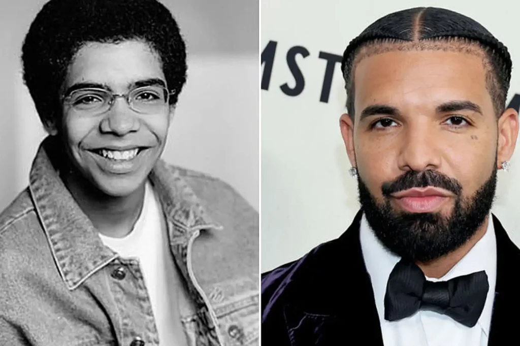 Drake Get Nose Surgery