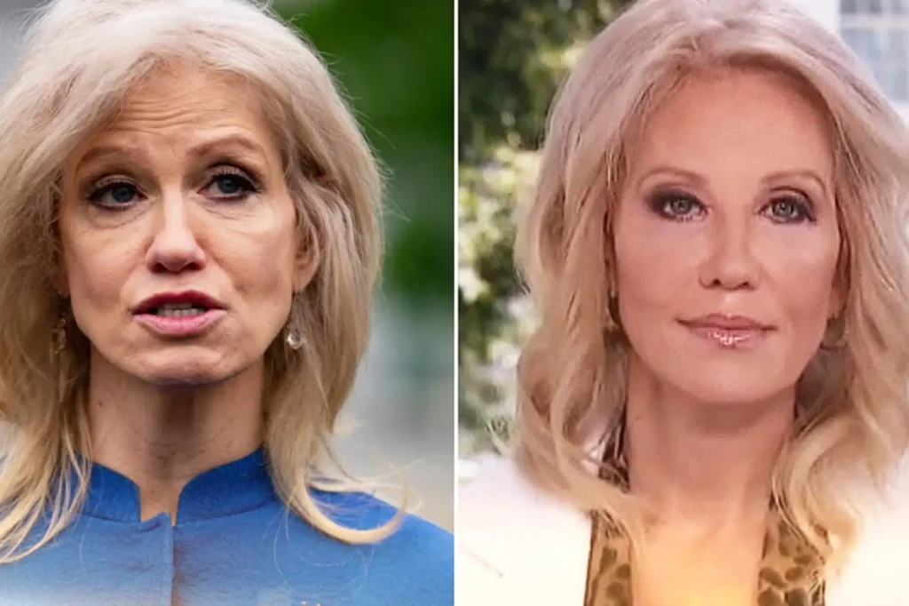 kellyanne conway before and after cosmetic surgery