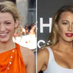 Blake Lively Nose Job