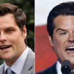 Matt Gaetz Before and After Cosmetic Surgery