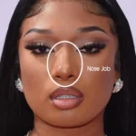 Megan Thee Stallion Nose Job