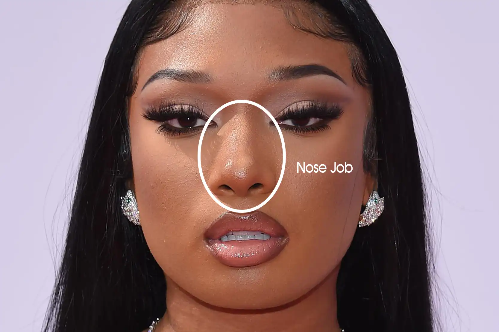 Megan Thee Stallion Nose Job