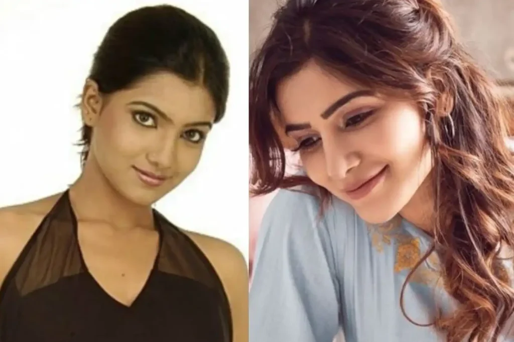 Samantha Ruth Prabhu Undergo Cosmetic Surgery