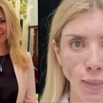 queen of russia before and after cosmetic surgery