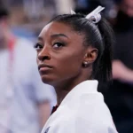 simone biles nose job