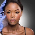 vanderbilt cosmetic surgery before and after