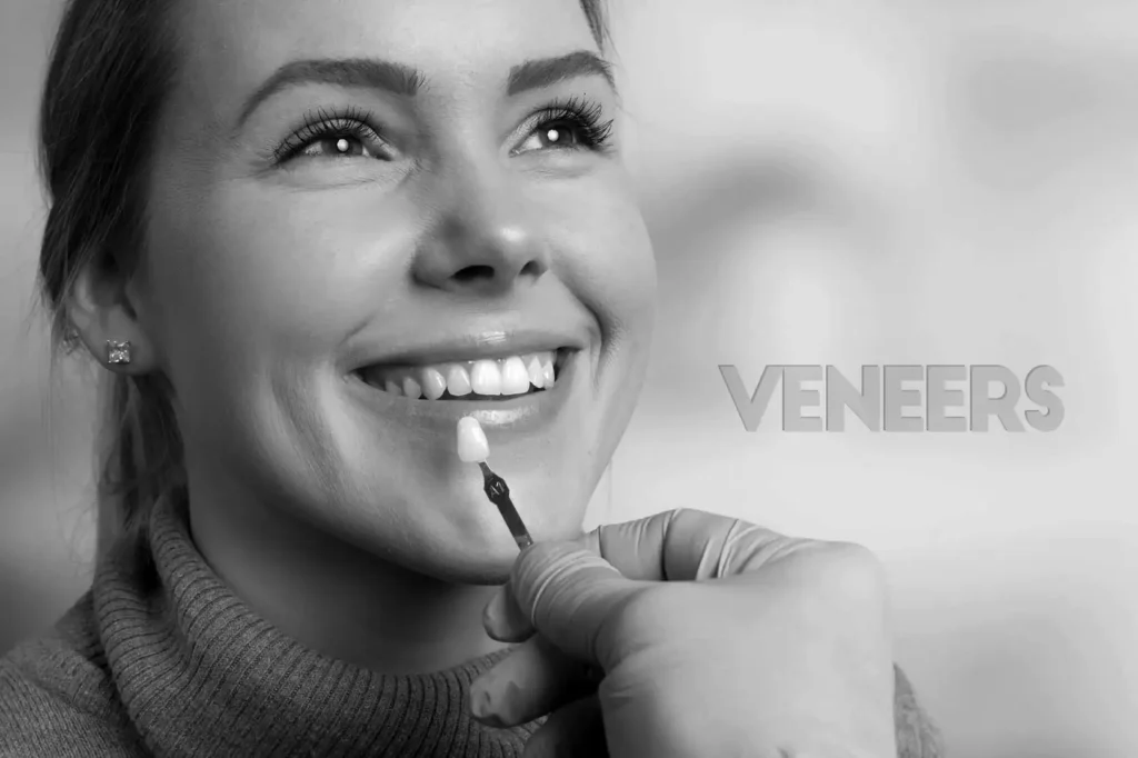 does insurance cover veneers