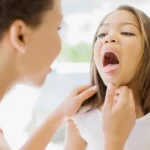 Is Strep Throat Contagious