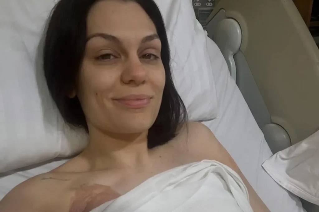Jessie J Undergoes Surgery