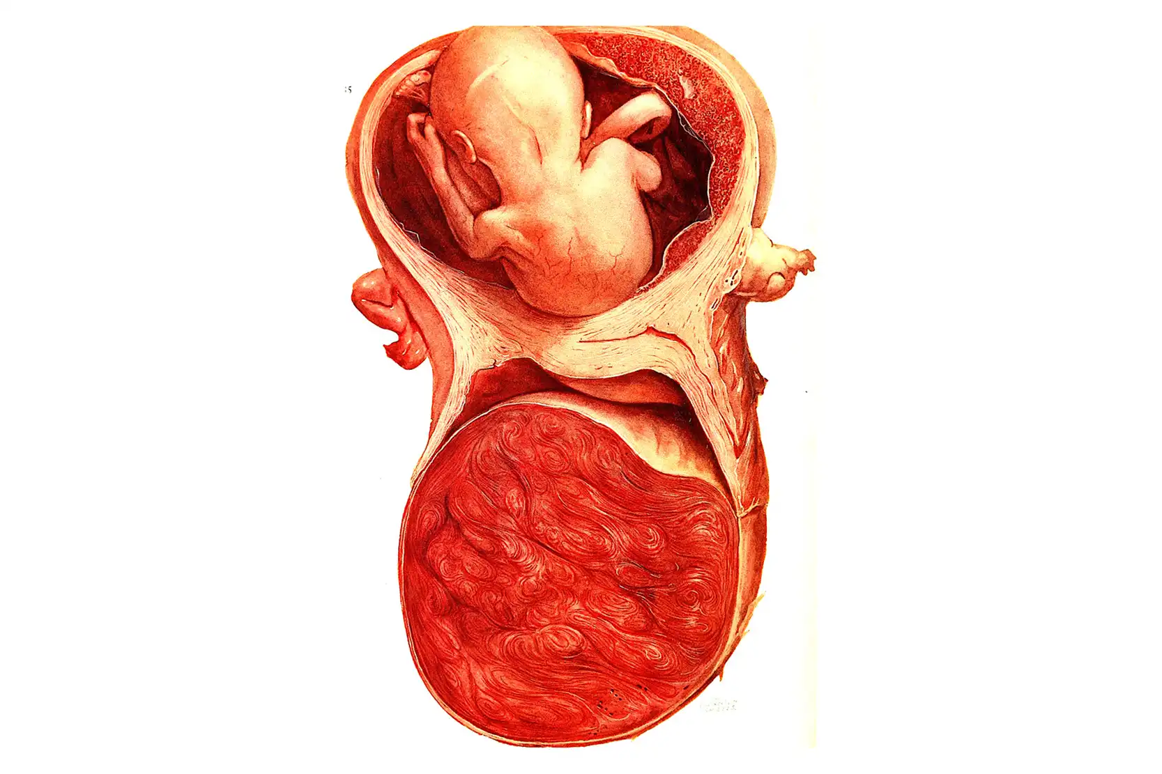 When Does Gestational Trophoblastic Disease Occur