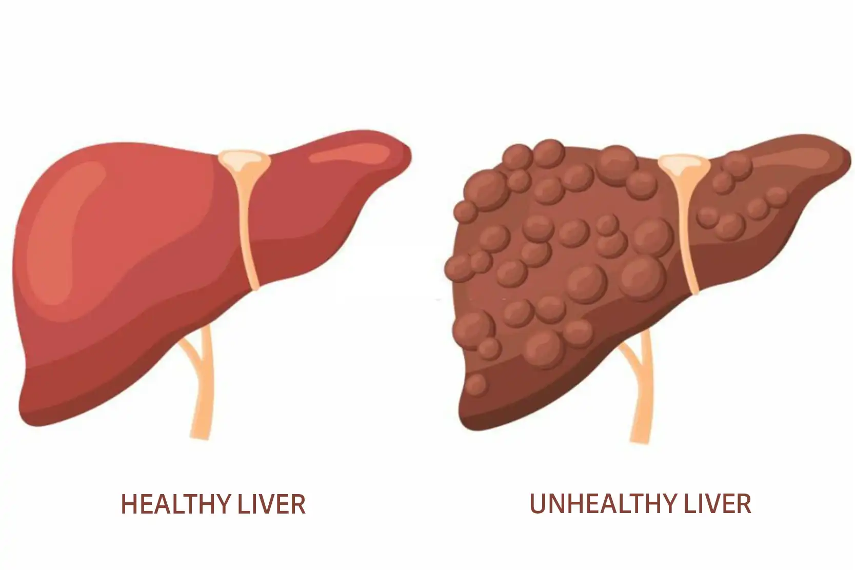diffuse hepatocellular disease