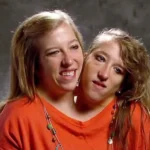 Abby and Brittany Hensel Age