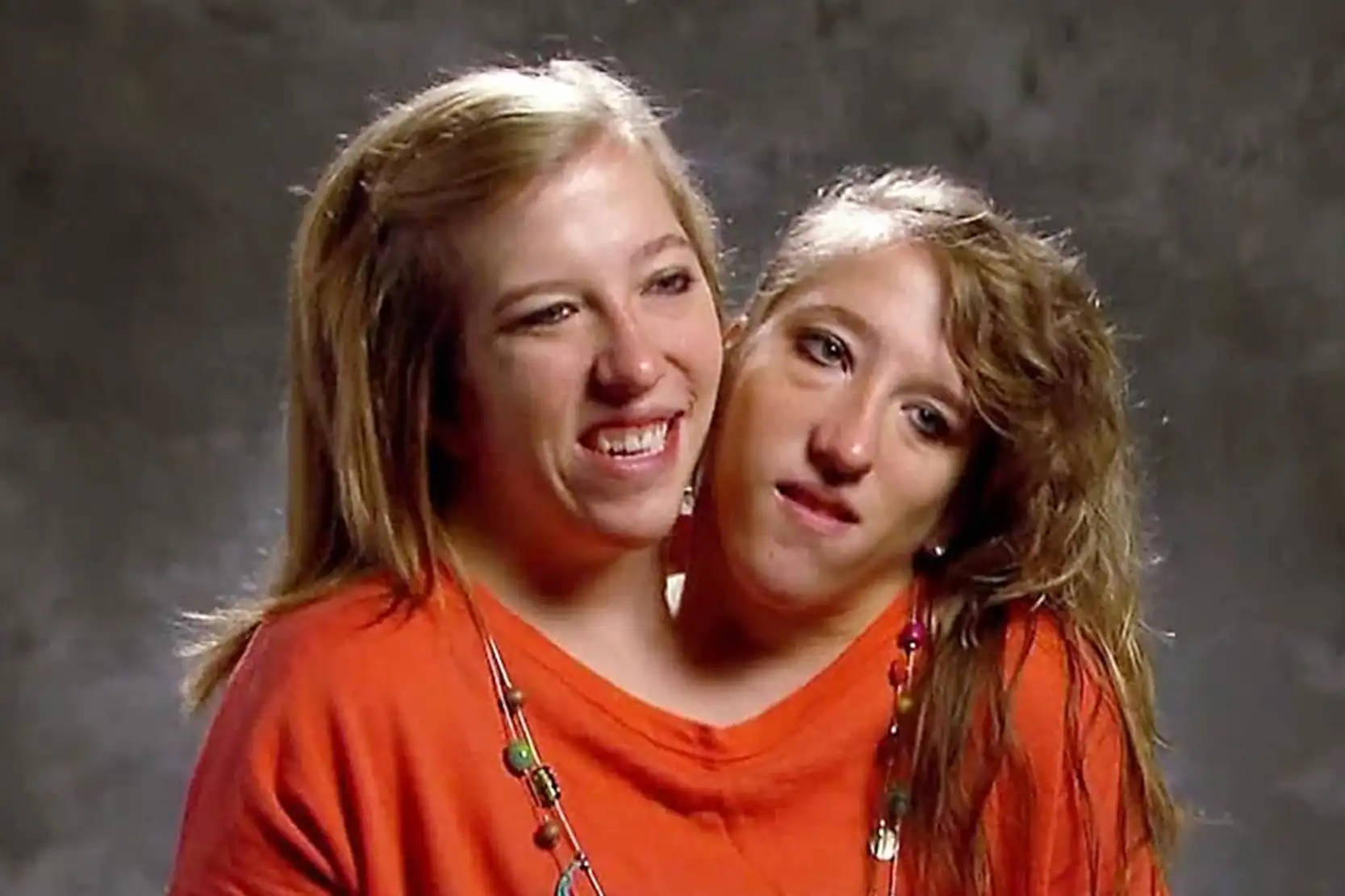 Abby and Brittany Hensel Age