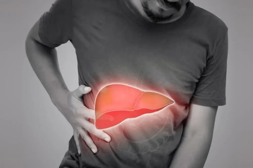 Polycystic Liver Disease