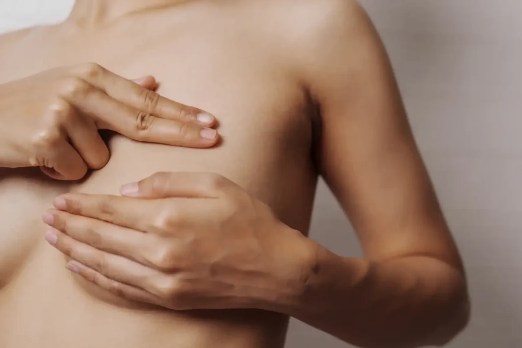 What is Calcification in the Breast