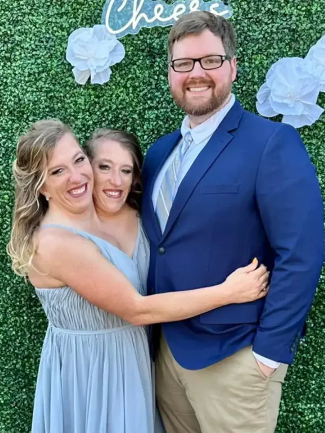 Abby and Brittany Hensel Age – Life Journey at 35