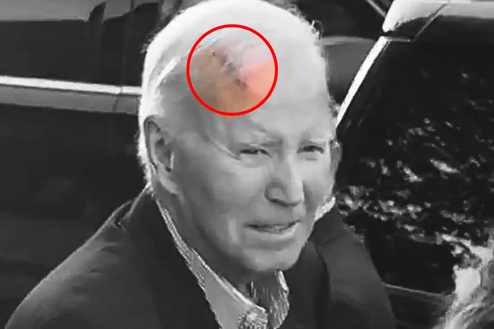 Joe Biden Scar on Head