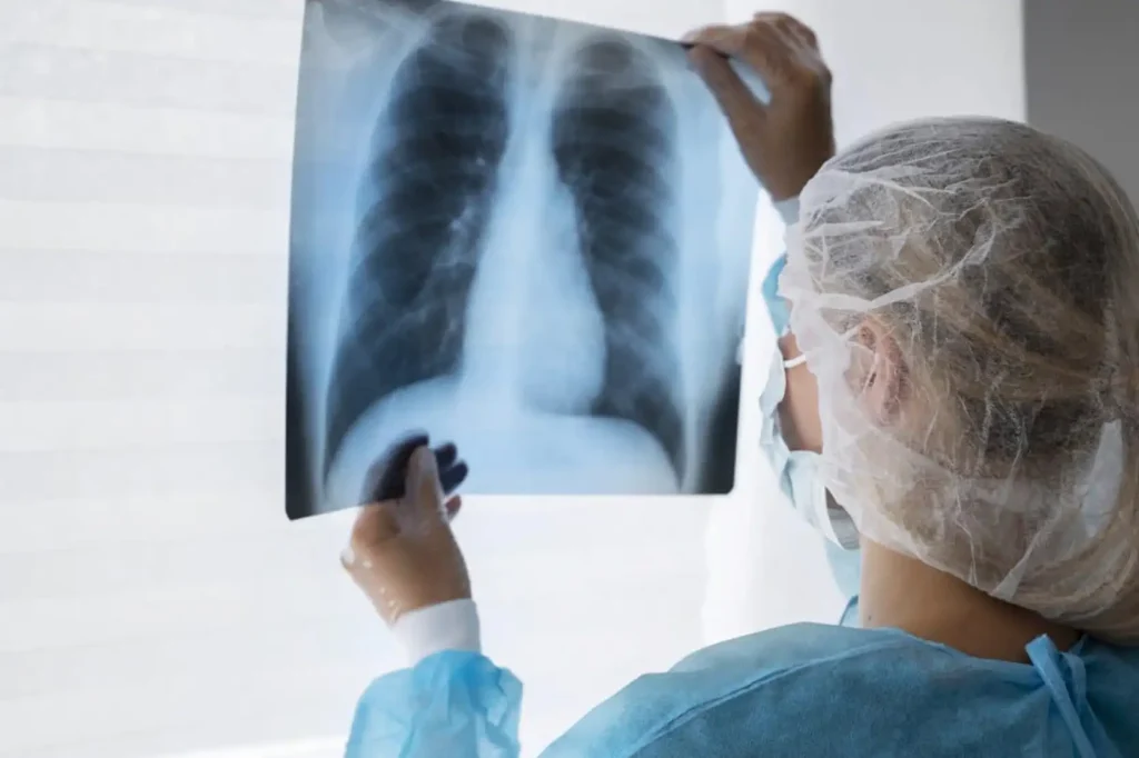 Tuberculosis Cases in Maine